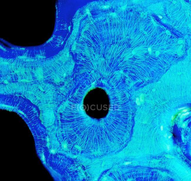 Haversian canals in compact bone, light micrograph. — Stock Photo