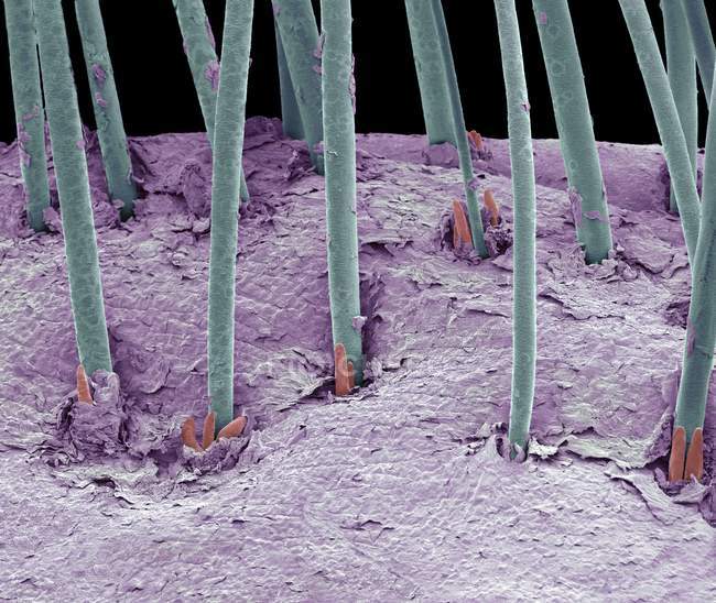Human eyelash mites — Stock Photo