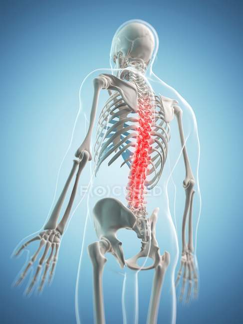 Pain in spinal vertebrae — Stock Photo