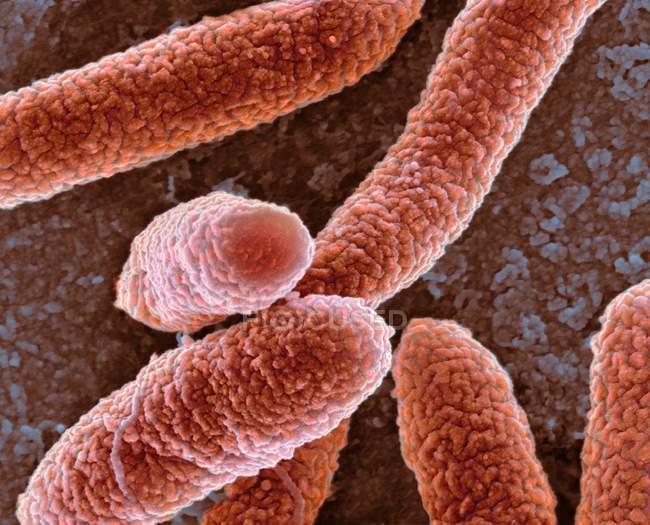 Bactérias Escherichia coli — Fotografia de Stock