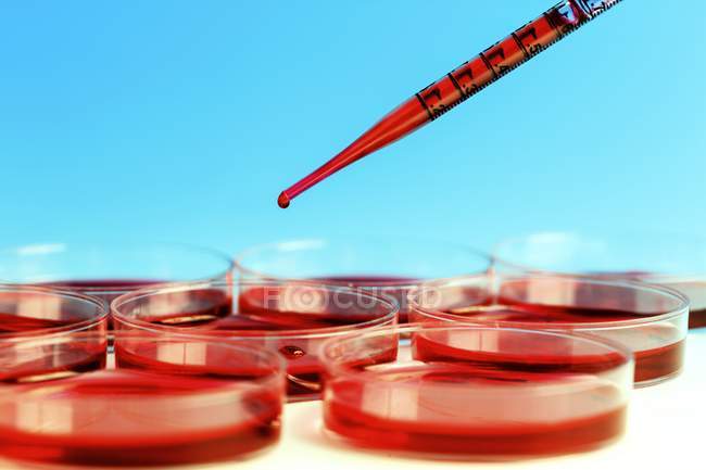 Placas de pipeta y petri para análisis de sangre
. - foto de stock