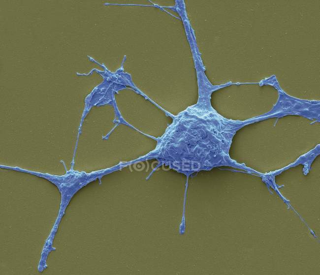 Micrographie électronique à balayage (SEM) d'un neurone PC12 en culture
. — Photo de stock
