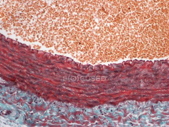 Sección de una arteria muscular - foto de stock