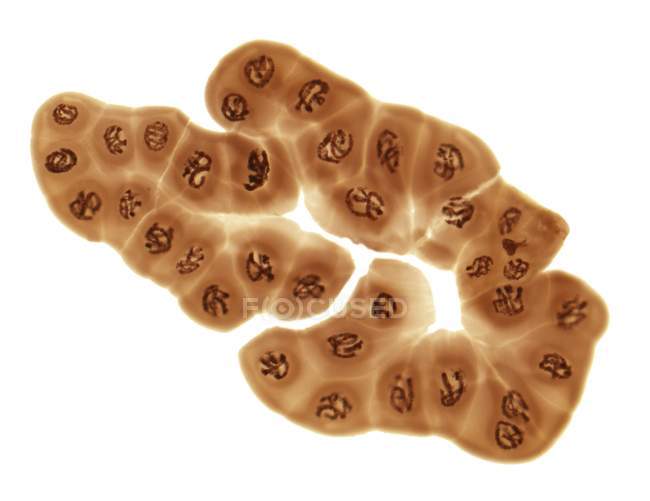 Cromosomas gigantes de politeno - foto de stock