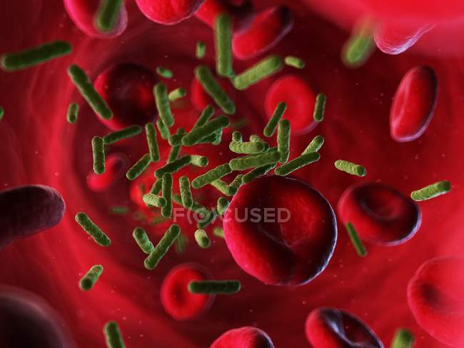 Infección bacteriana que se propaga en el torrente sanguíneo - foto de stock
