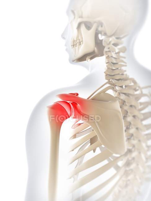 Dor e desconforto nas articulações do ombro — Fotografia de Stock