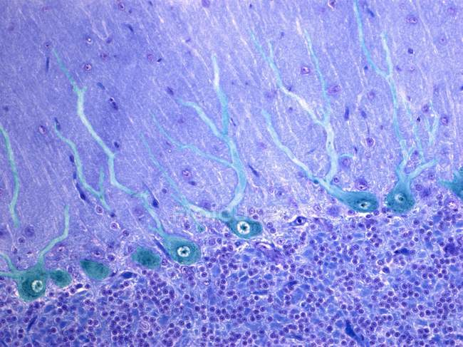 Purkinje neurons in the cerebellum — Stock Photo