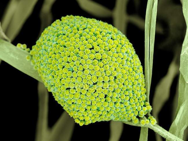 Células fúngicas de esporangio con esporas - foto de stock