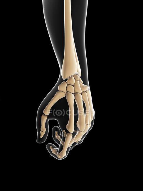 Représentation schématique de la douleur au poignet — Photo de stock