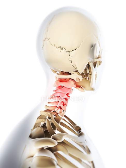 Douleur localisée dans les vertèbres cervicales — Photo de stock