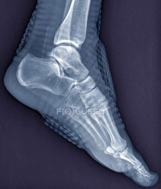 Healthy ankle joint — Stock Photo