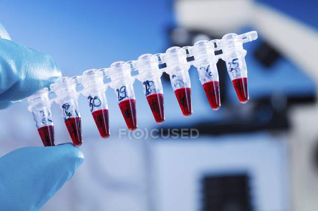 Primer plano del científico que sostiene microtubos de análisis de sangre
. - foto de stock