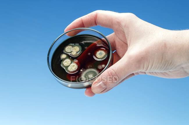 Person hand holding petri dish with biological culture. — Stock Photo