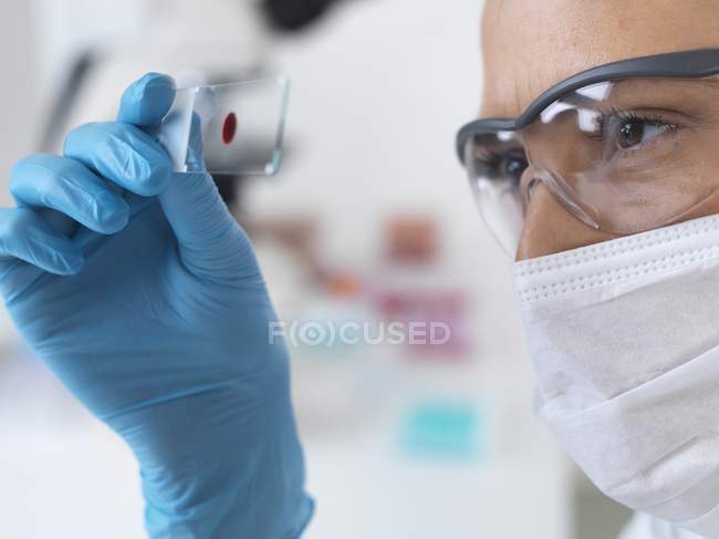 Científica sosteniendo portaobjetos de microscopio con muestra de sangre . - foto de stock