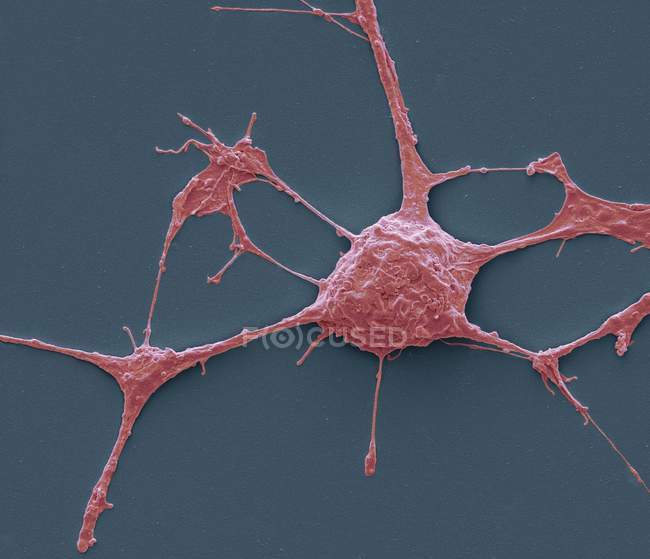 Neurone PC12 en culture — Photo de stock