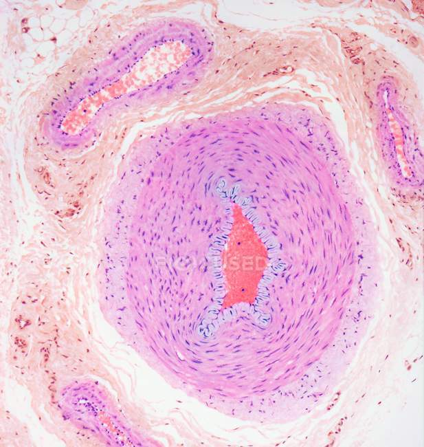 Micrographie photonique d'une section à travers les tissus montrant une artère (au milieu) et une veine (en haut à gauche) ). — Photo de stock