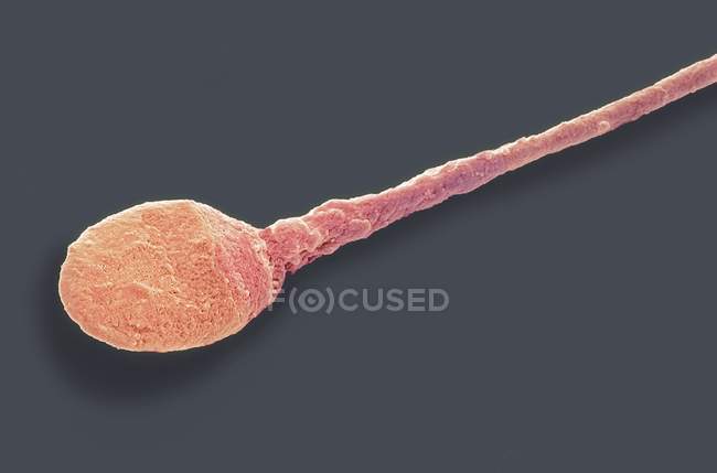 Sexo masculino célula — Fotografia de Stock