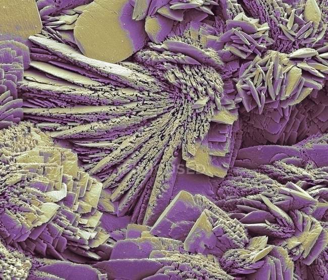 Limescale, micrographie électronique à balayage coloré (SEM ). — Photo de stock