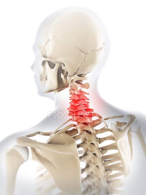 Dor localizada em vértebras cervicais — Fotografia de Stock