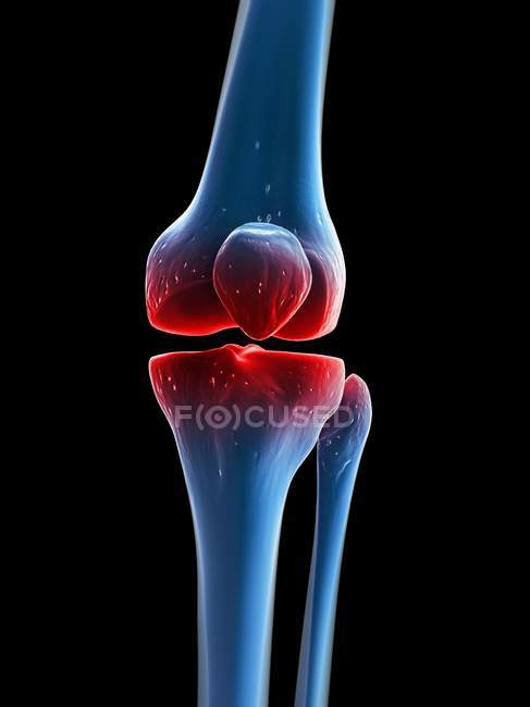 Visualización de la rodilla dolorosa - foto de stock