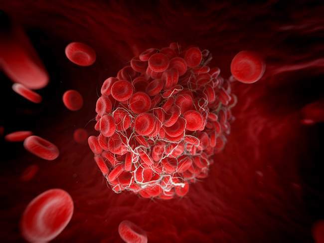Blood clot formed by red blood cells — Stock Photo