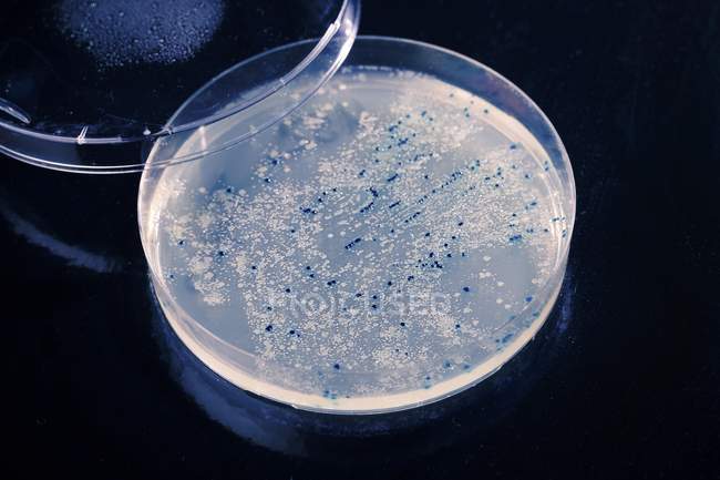 Microbios creciendo en una placa Petri - foto de stock