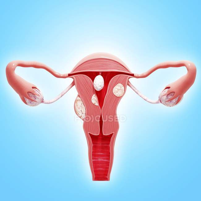 Anatomía patológica del cáncer uterino - foto de stock
