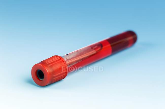 Blood sample in tube on blue background. — Stock Photo