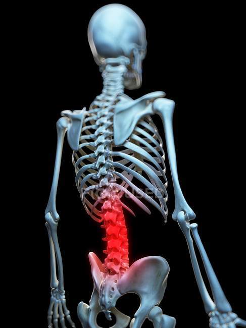 Visualización de espalda dolorosa - foto de stock