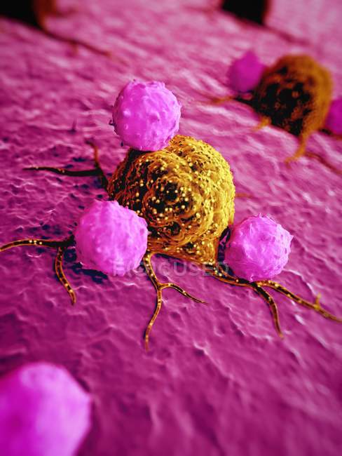 Células cancerosas y glóbulos blancos - foto de stock
