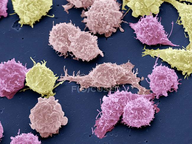 Cultured cancer cells — Stock Photo
