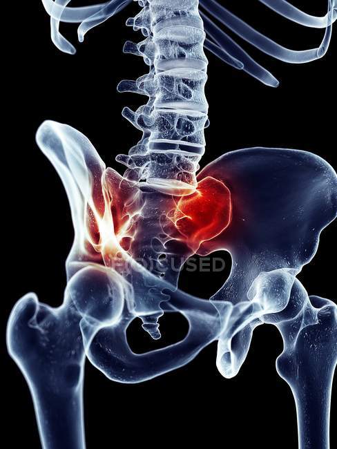 Douleur de hanche humaine — Photo de stock