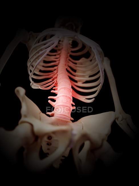 Inflamación de la columna vertebral humana - foto de stock