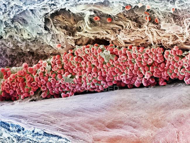 Coagulo di sangue o trombo — Foto stock