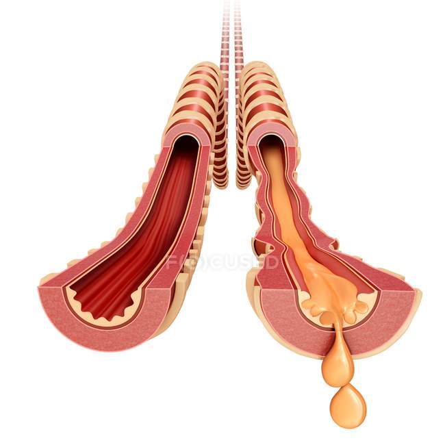 Bronches infectées par le mucus — Photo de stock