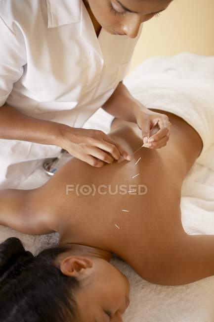 Akupunkteur steckt Nadel in weibliche Klientin zurück. — Stockfoto