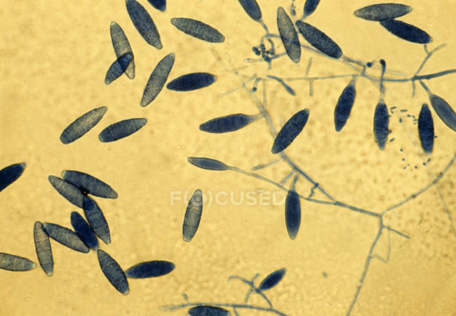 Hongos Microsporum gypseum - foto de stock