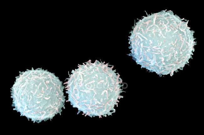 Coloured scanning electron micrograph (SEM) of human myeloid white blood cells found in bone marrow. — Stock Photo