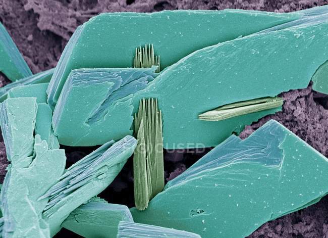 Albumen crystals, coloured scanning electron micrograph (SEM). — Stock Photo