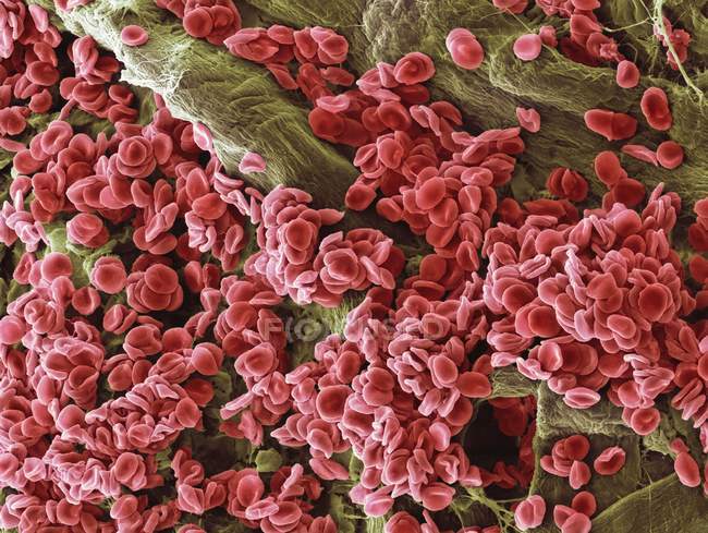 Red blood cells aggregated — Stock Photo