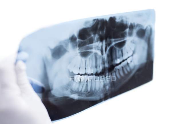 Dentist holding medical x-ray on white background. — Stock Photo