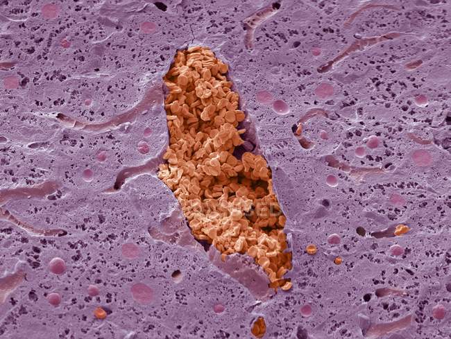 Micrografía electrónica de barrido de color (SEM) de una sección a través de una vena en el hígado, que está llena de glóbulos rojos (eritrocitos, rojos) ). - foto de stock