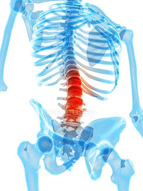 Dolor espinal humano - foto de stock