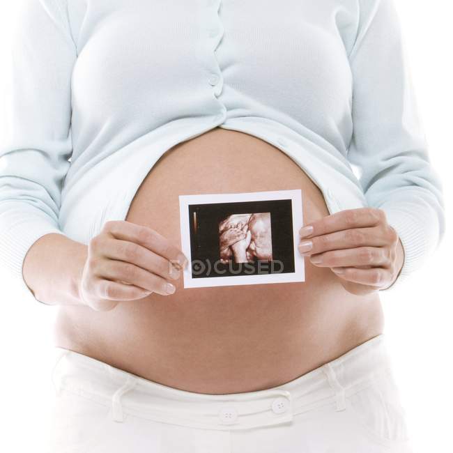 Pregnant woman holding baby scan printout. — Stock Photo