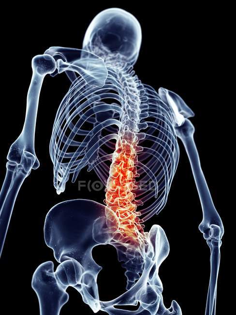 Human spine pain — Stock Photo