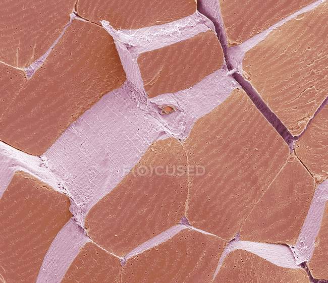 Micrografo elettronico a scansione colorata (SEM) di una sezione attraverso il muscolo scheletrico fratturato per mostrare grandi fasci muscolari, o fascicoli (verde), circondato da tessuto connettivo perimetrale (rosa
). — Foto stock