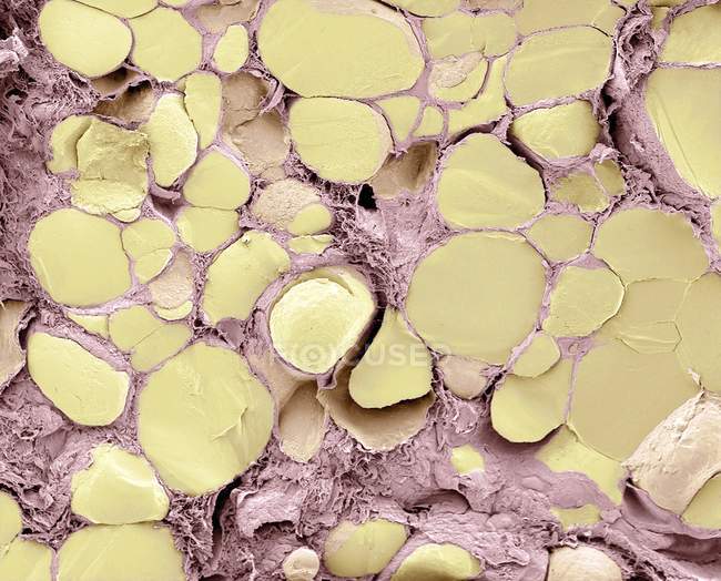 Micrografo elettronico a scansione colorata (SEM) di una frattura attraverso la ghiandola tiroidea che rivela diversi follicoli (giallo ). — Foto stock