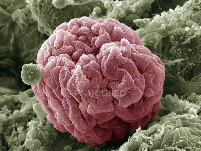 Glomérulos renais e células podócitas — Fotografia de Stock