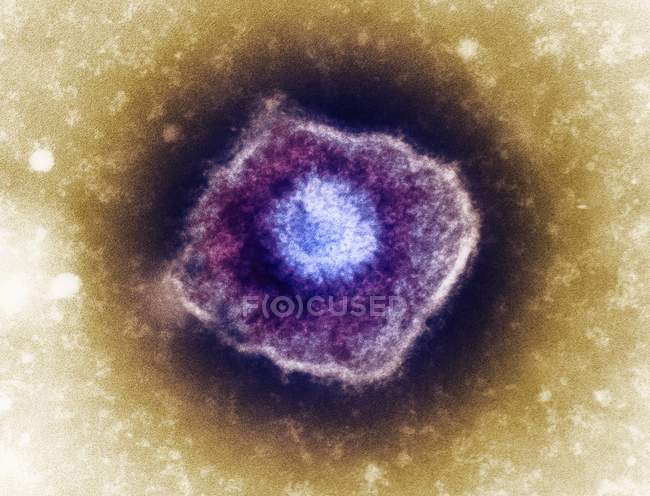 Partícula del virus varicela zoster - foto de stock