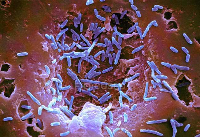 Bacterias de Mycobacterium chelonae - foto de stock